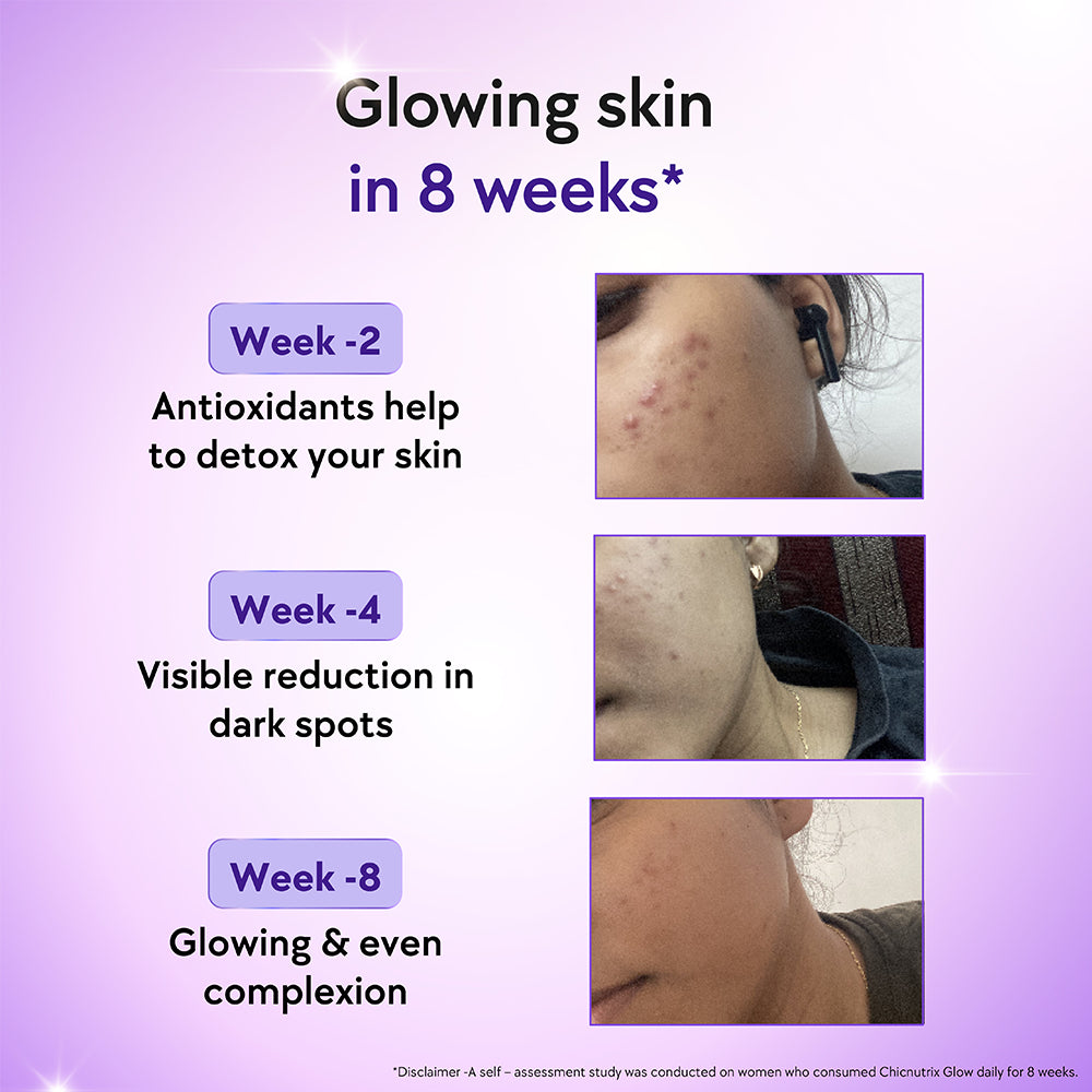 Chicnutrix Glow - Glutathione & Vitamin C for Radiant Skin
