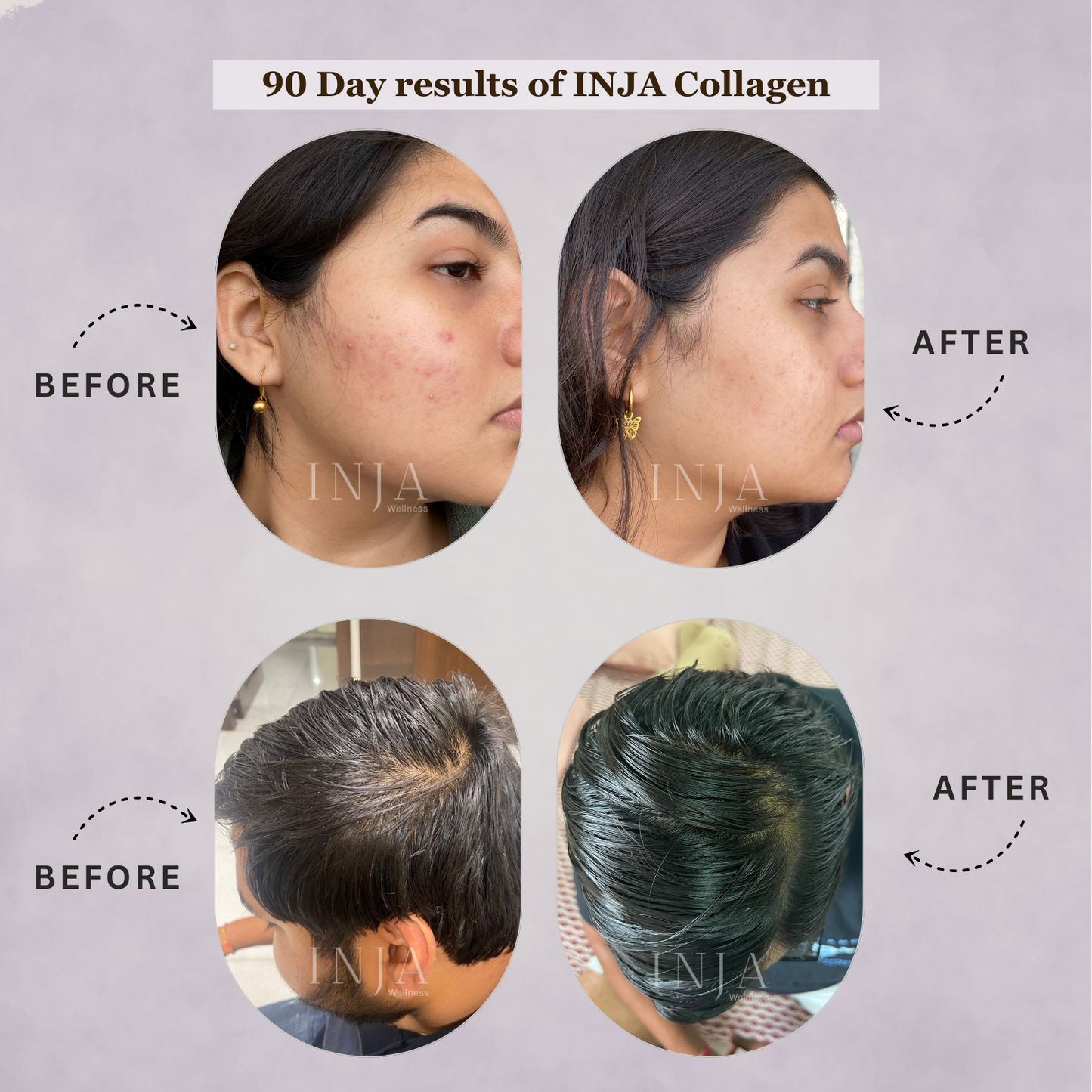 INJA Fit Marine Collagen | Boost Health & Vitality