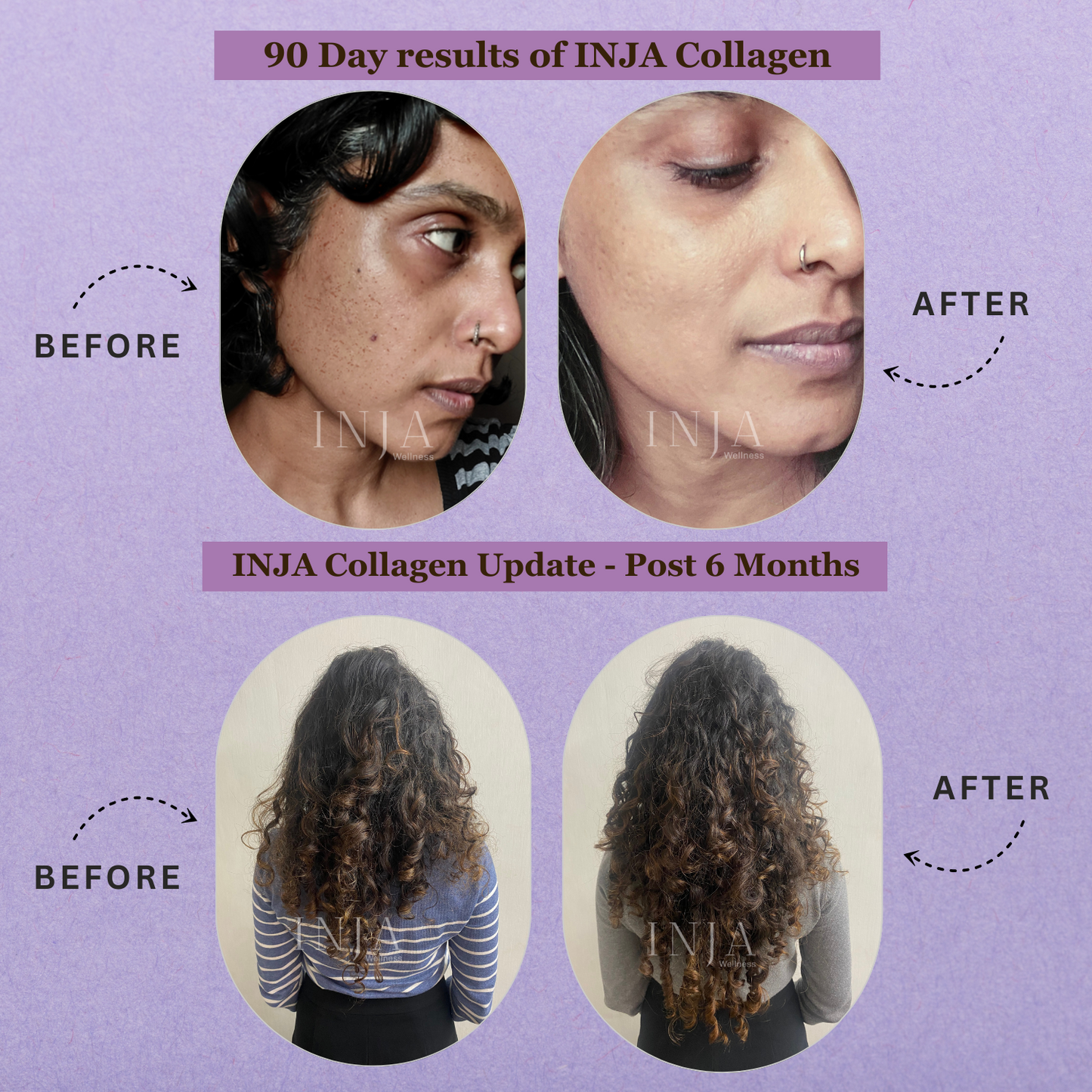 INJA Veg Collagen Supplement | Plant-Based Skin Support